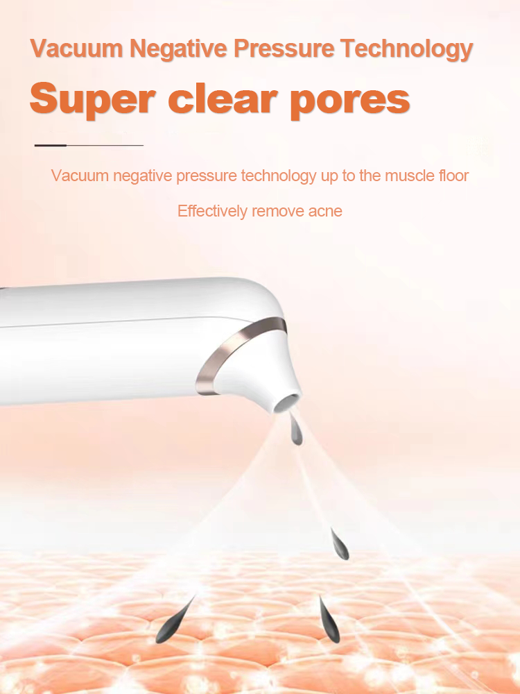 Electric Bubble Blackhead/Pimple Remover