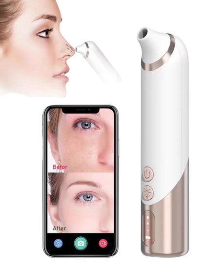 Electric Bubble Blackhead/Pimple Remover