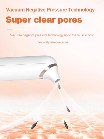 Electric Bubble Blackhead/Pimple Remover